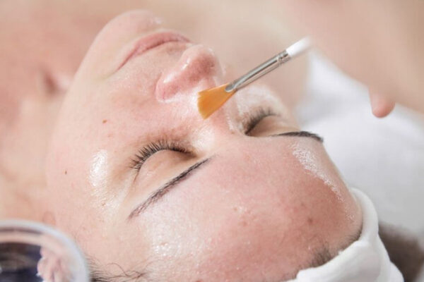 Peeling Facial