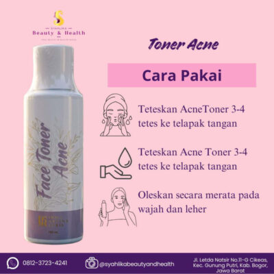 Toner Acne